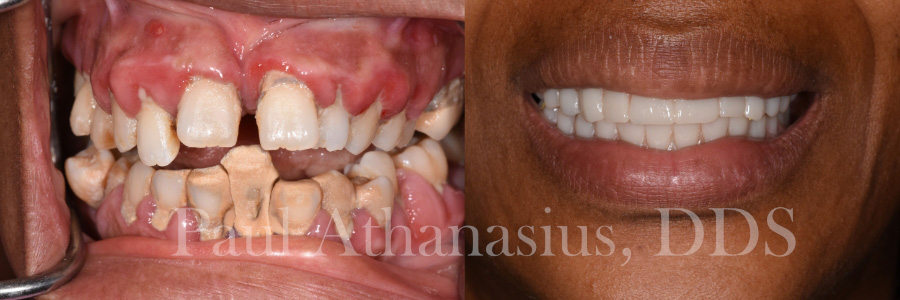 Genuine Family Dentistry | Intraoral Camera, Root Canals and Botox reg