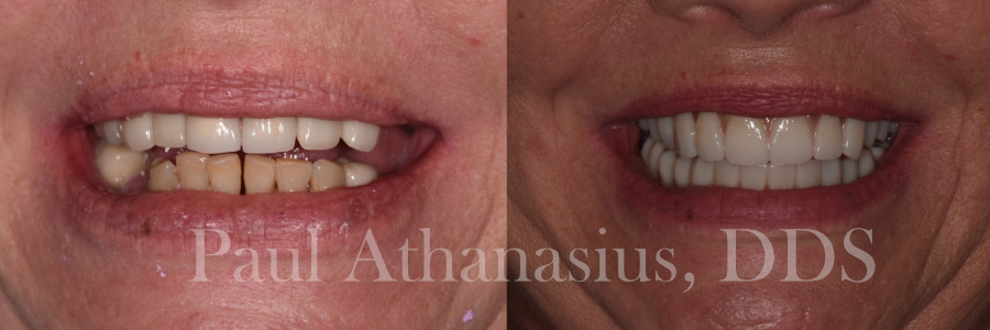 Genuine Family Dentistry | Cosmetic Dentistry, Crowns and Emergency Treatment