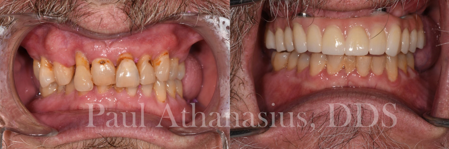 Genuine Family Dentistry | Dental Lab, Implant Dentistry and Oral Cancer Screening