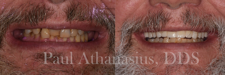 Genuine Family Dentistry | All-on-6 reg , Cosmetic Dentistry and All-on-4 reg