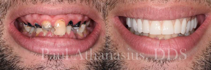 Genuine Family Dentistry | Botox reg , All-on-6 reg  and Sedation Dentistry