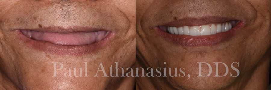 Genuine Family Dentistry | Pediatric Dentistry, Implant Restorations and Oral Exams