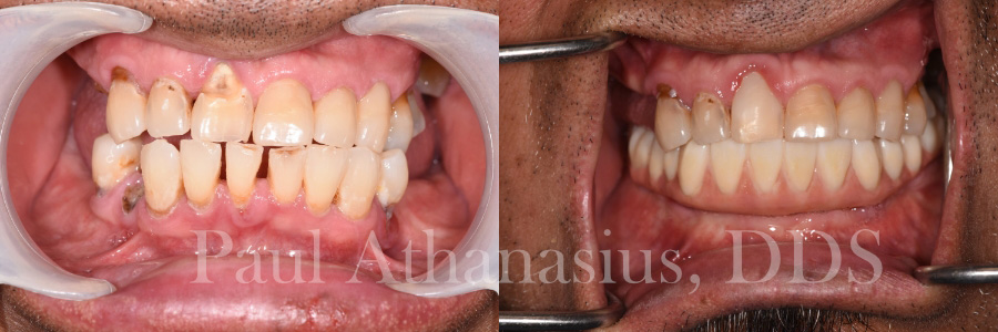 Genuine Family Dentistry | Preventative Program, Dental Cleanings and Dental Lab