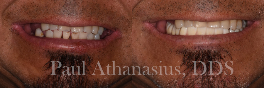 Genuine Family Dentistry | Full Mouth Reconstruction, Intraoral Camera and ZOOM  Whitening